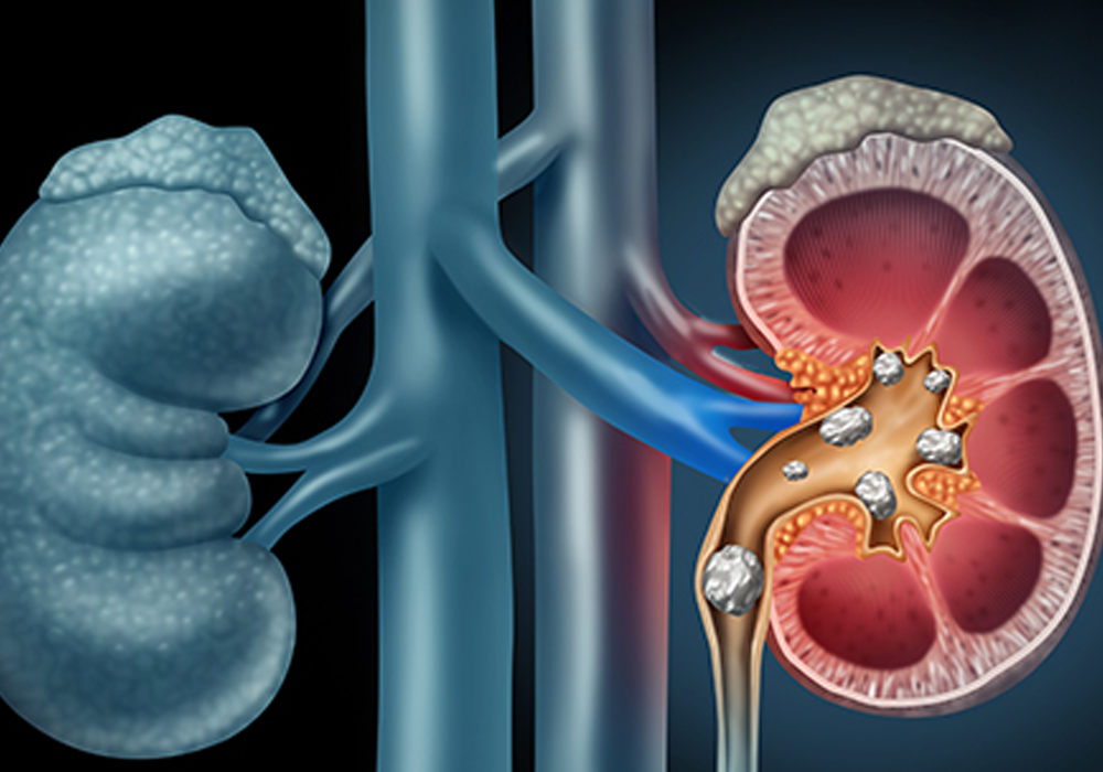 pulmonology image red in colour