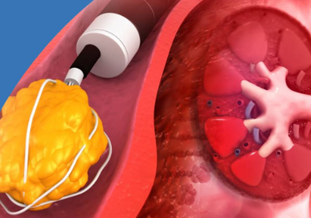 pulmonology image red in colour